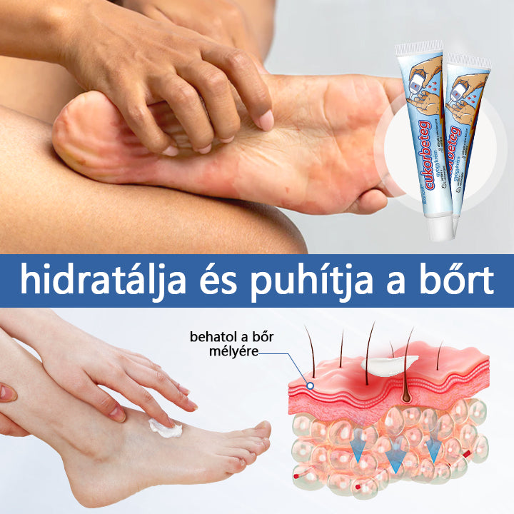 ✅Biancat™ VitaGluco cukorbetegség kezelésére szolgáló krém