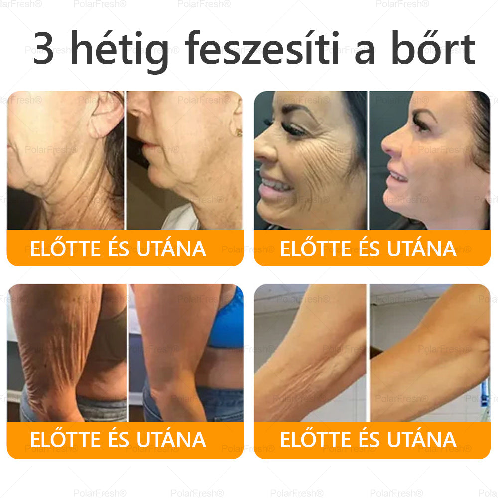 Daasry® Méhméreg Krém – Természetes bőrfeszesítés és ránctalanítás klinikai hatékonysággal! ✨✨✨