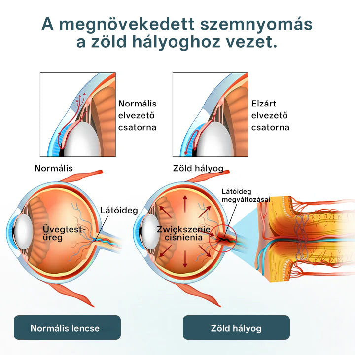 🔥Laleia® OptiFusion Nano szemcsepp szérum🎉