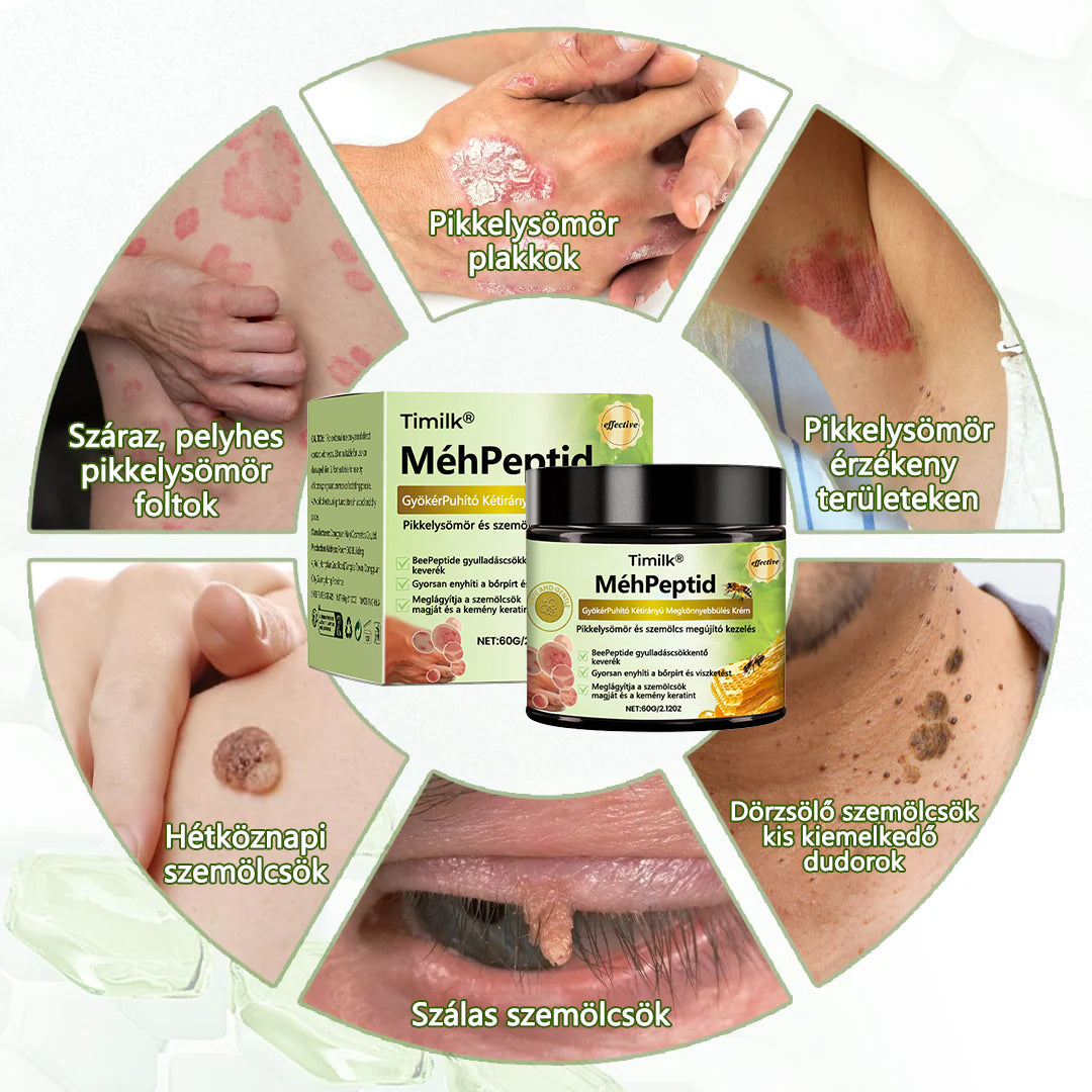 🔥🔥Timilk® MéhPeptid GyökérPuhító Kétirányú Megkönnyebbülés Krém