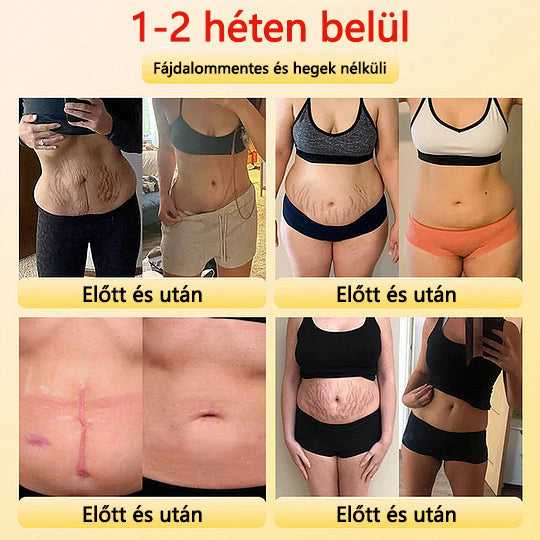 🎉 Korlátozott idejű ajánlat - hatalmas kedvezmény! 🔥 Akár 90% KEDVEZMÉNY! Sfrcord™ titánszálas önmelegedő turmalin formáló rövidnadrág✅