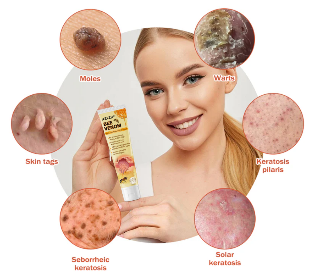 AEXZR™ Méhméreg vakond és szemölcs kezelési krém