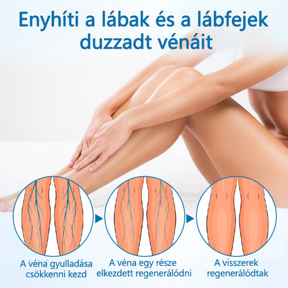 Timilk® VeinGuard Herbal Spray-✅ Klinikailag bizonyítottan 7 nap alatt megszünteti a visszerességet!