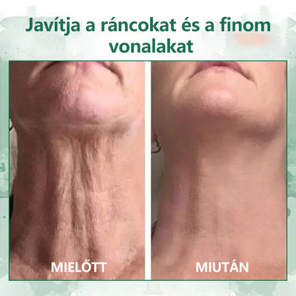 🌿💝A 60%-os akció utolsó napja - Fubsta™ öregedésgátló bőrfeszesítő szérum🔥🔥