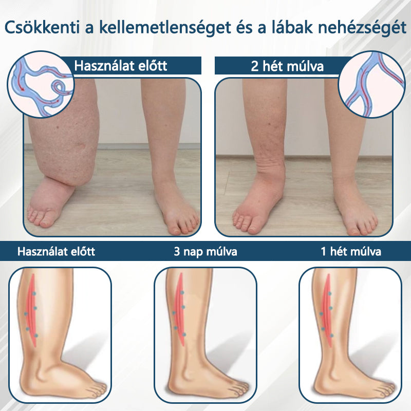 💧💧💧ATTDX® Növényi ödéma enyhítő krém nigellával