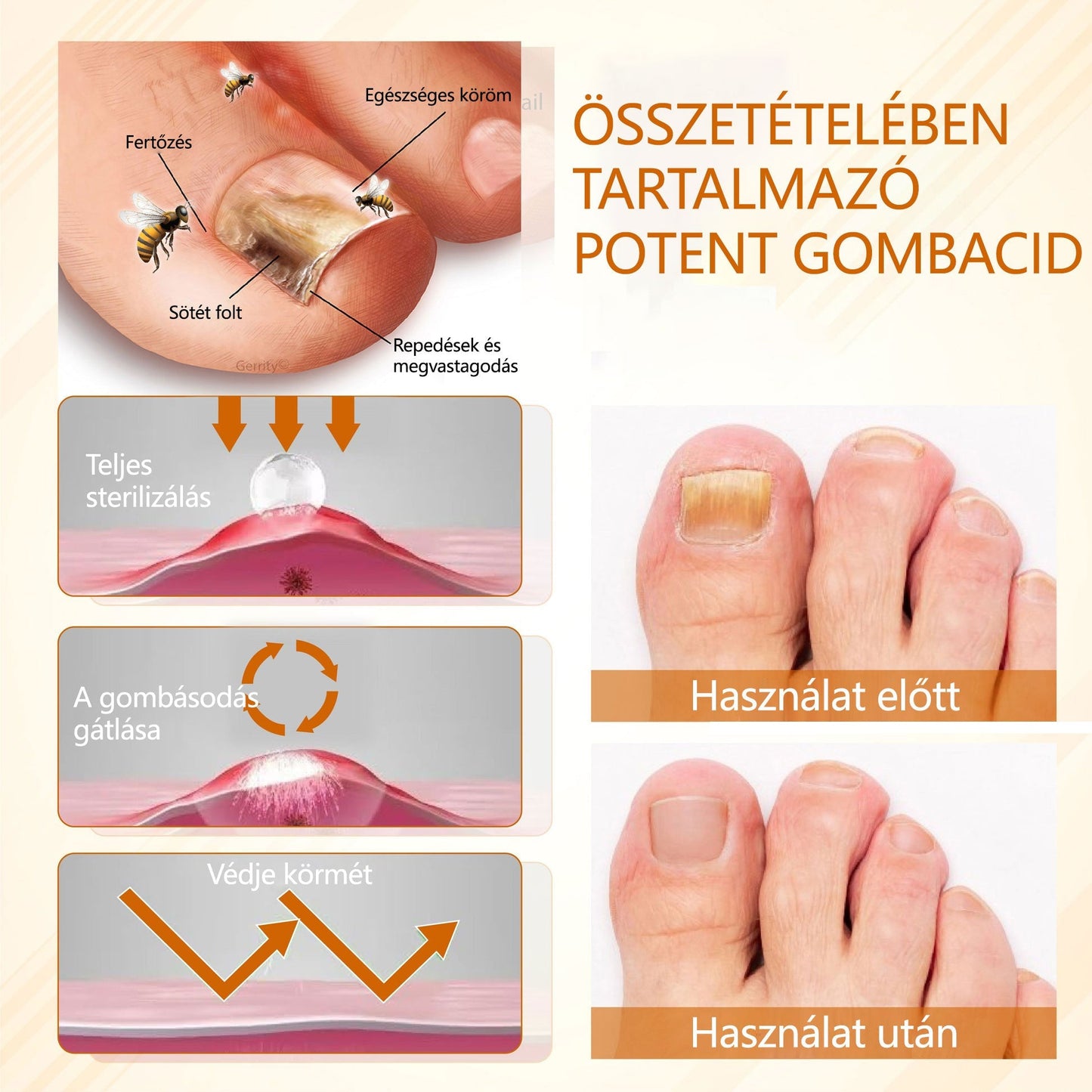 Croaie® Fungiclear Bee Therapy Nail Spray🎁