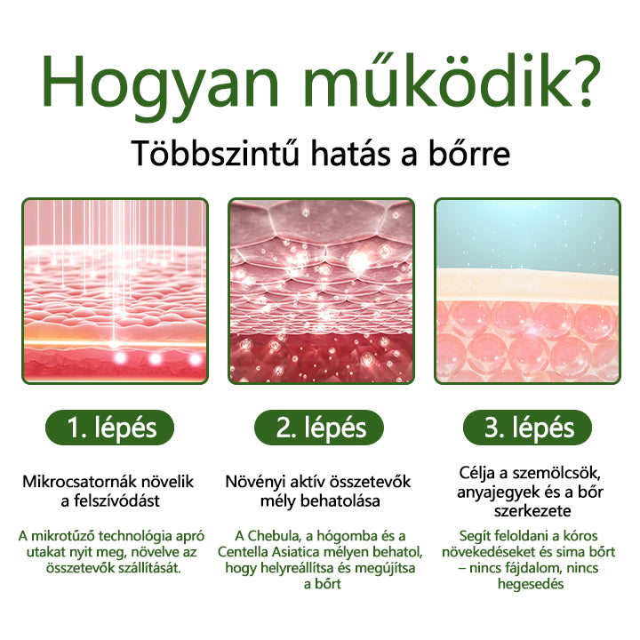 👨‍⚕️👨‍⚕️👨‍⚕️👨‍⚕️Timilk® Dél-Korea WartClear Intenzív Ampulla