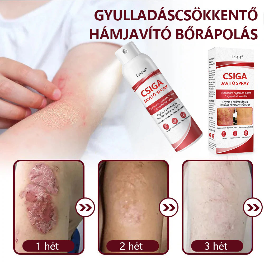 🔥Laleia® csigahéjas spray viszkető, hámló pikkelysömörös bőrre