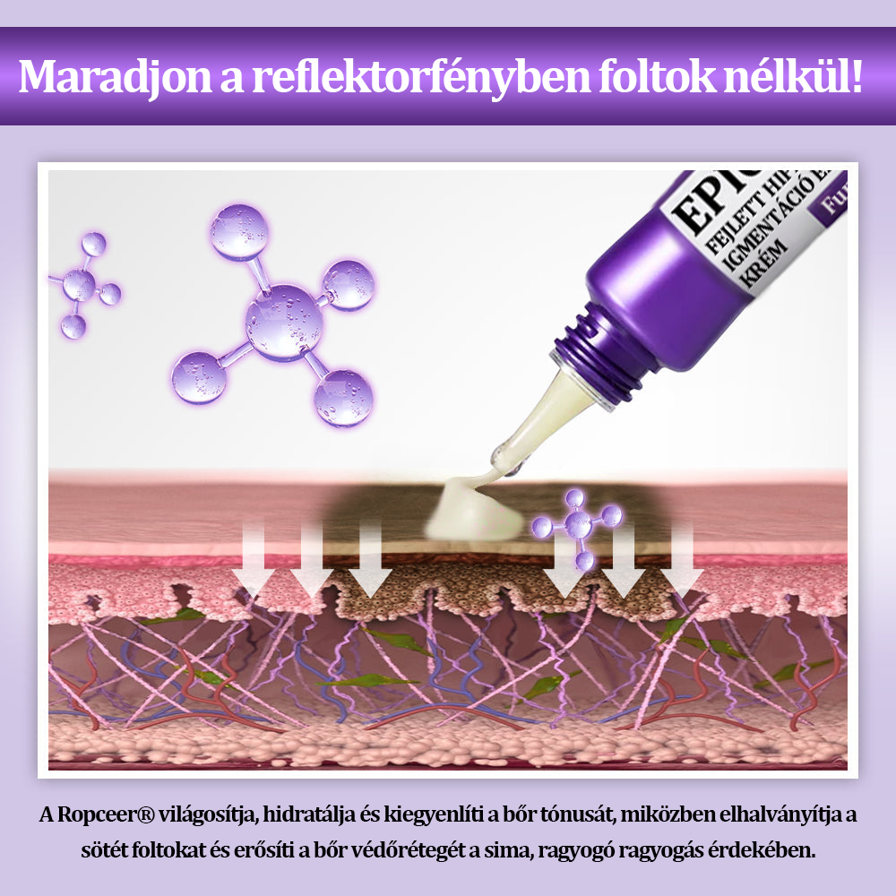 🔥🔥𝐎𝐆𝐘É𝐈 által jóváhagyva | 𝐅𝐮𝐫𝐳𝐞𝐫𝐨® 𝐄𝐏𝐈𝐆𝐋𝐎𝐖 𝐌𝐞𝐥𝐚𝐧𝐄𝐗 Fejlett Hiperpigmentáció Elleni Krém