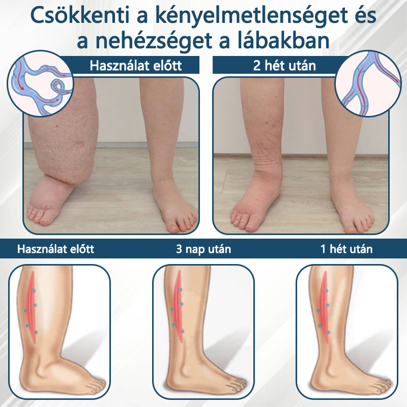 ✅✅ODEIUN® Fekete kömény Ödéma méregtelenítő gyógynövénykrém