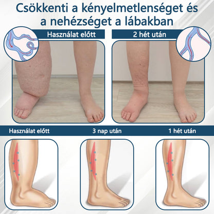 ✅✅ODEIUN® Fekete kömény Ödéma méregtelenítő gyógynövénykrém