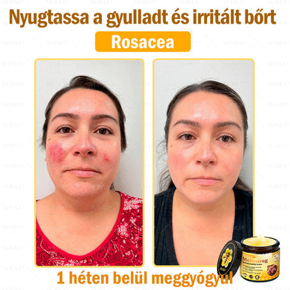 💪VLSVLS® Méhméreg Bőrhelyreállító Krém (👨‍⚕‍CE jóváhagyott)👍✅✅