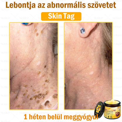 💪VLSVLS® Méhméreg Bőrhelyreállító Krém (👨‍⚕‍CE jóváhagyott)👍✅✅