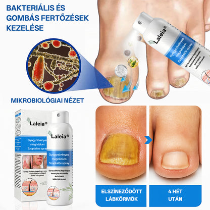 ⭐Laleia® 🎉Magnézium Gyógynövényes Pszoriázis Spray