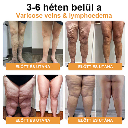 【 ⭐ utánvétel (COD) ⭐ 】𝐉𝐎𝐒𝐅𝑰𝐓™ ultrahangos zsírfúvás és távoli infravörös vércukorszint-kiegyenlítő méregtelenítő csuklópánt - Energy Balance 🔥 Korlátozott idejű akció 🔥