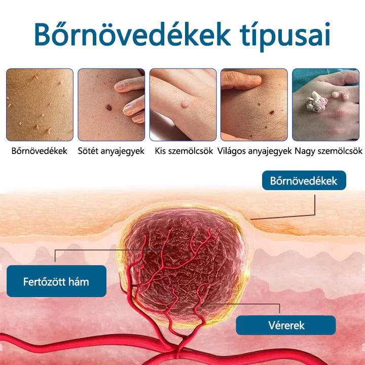 🔥🔥Timilk® DermaVenom RX+ precíziós eltávolító krém