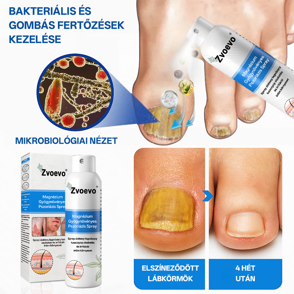 🔥🔥🔥Zvoevo® 🎉Magnézium Gyógynövényes Pszoriázis Spray