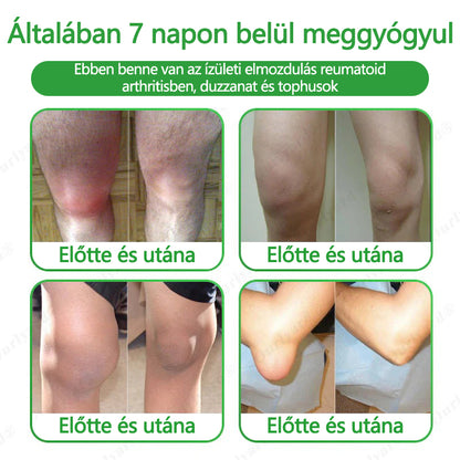 👨‍⚕️👨‍⚕️✅Ourlyard® Advanced Magnesium & Emu Oil Massage Pain Relief Cream (🏅A végső megoldás izomfájdalmak, ízületi gyulladás, ízületi fájdalom, idegfájdalom, gyulladás és merevség esetén) – Gyártva az USA-ban