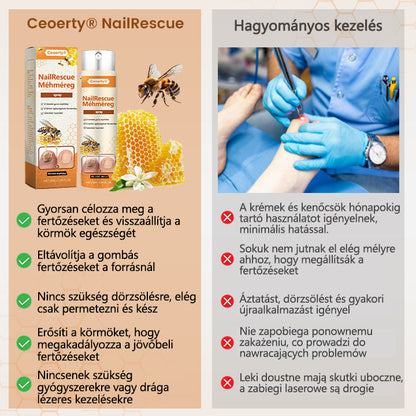 ✅[Korlátozott idejű ajánlat, érkezési sorrendben]✅Ceoerty® NailRescue méhméreg spray
