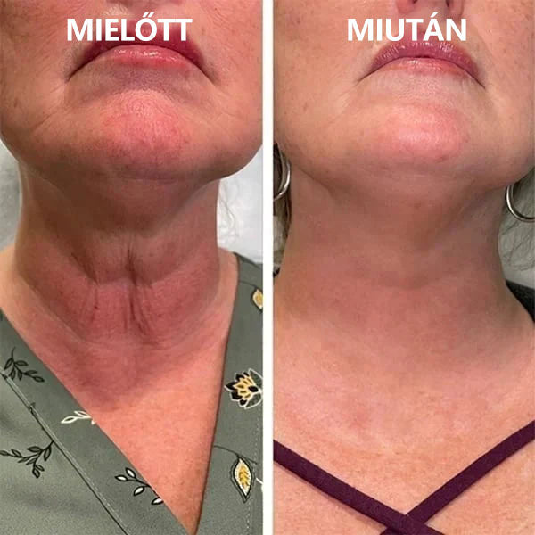 🌿💝A 60%-os akció utolsó napja - Fubsta™ öregedésgátló bőrfeszesítő szérum🔥🔥