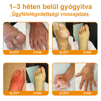 Lidocain Fájdalomcsillapító Roll-On Gélt(csökkenti az ízületi duzzanatot, fájdalmat, merevséget, bőrpírt, melegséget, fájdalmat és ízületi fáradtságot ), 4% Lidocain, Glükozamin, MSM, Arnica, Chondroitin, K2-vitamin🔥