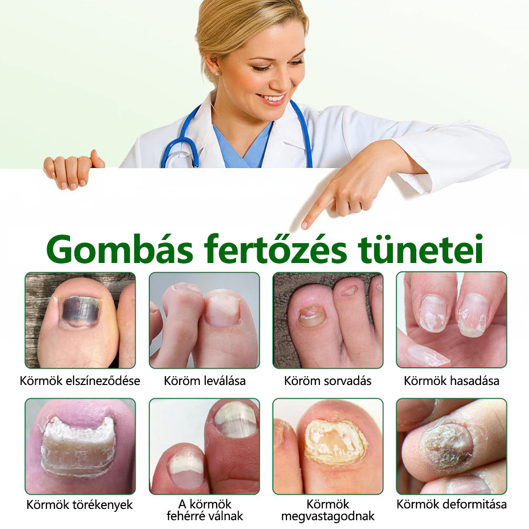 Timilk® HerbaNail 7 napos regeneráló szérum 🔥🔥 FDA tanúsítvánnyal rendelkezik