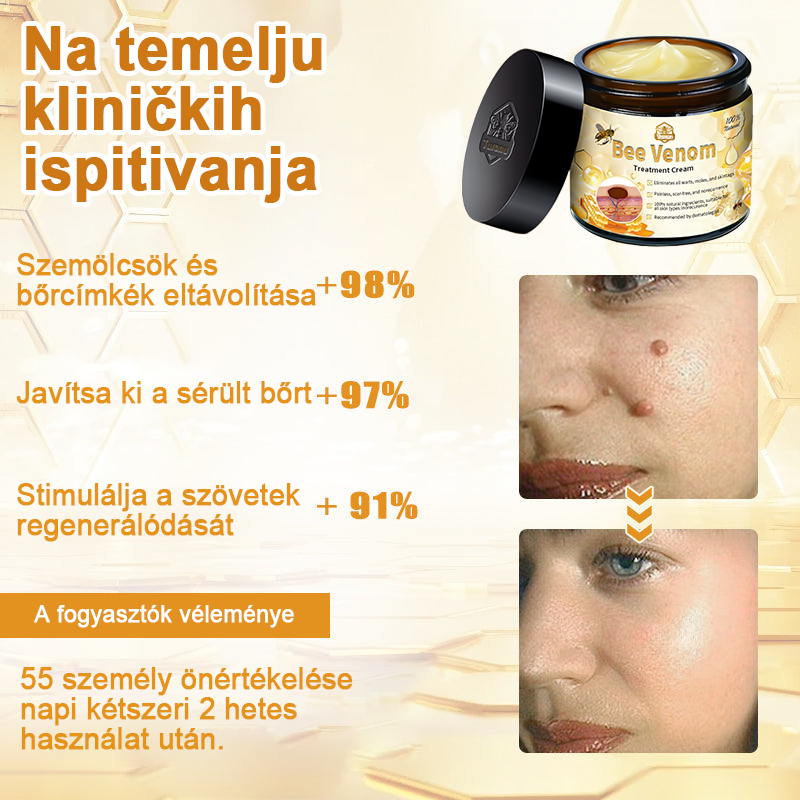 🏵️[Hivatalos zászlóshajó üzlet] 𝑻𝒖𝒓𝒐𝒏𝒖™ méhméreg bőrápoló krém (👨‍⚕𝐀𝐀𝐃 JAVASLATOK)
