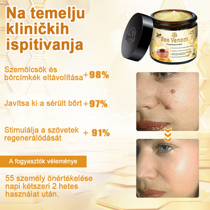 🏵️[Hivatalos zászlóshajó üzlet] 𝑻𝒖𝒓𝒐𝒏𝒖™ méhméreg bőrápoló krém (👨‍⚕𝐀𝐀𝐃 JAVASLATOK)