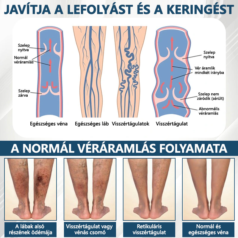 Cvreoz® Fekete kömény Ödéma méregtelenítő gyógynövénykrém🌿🌿