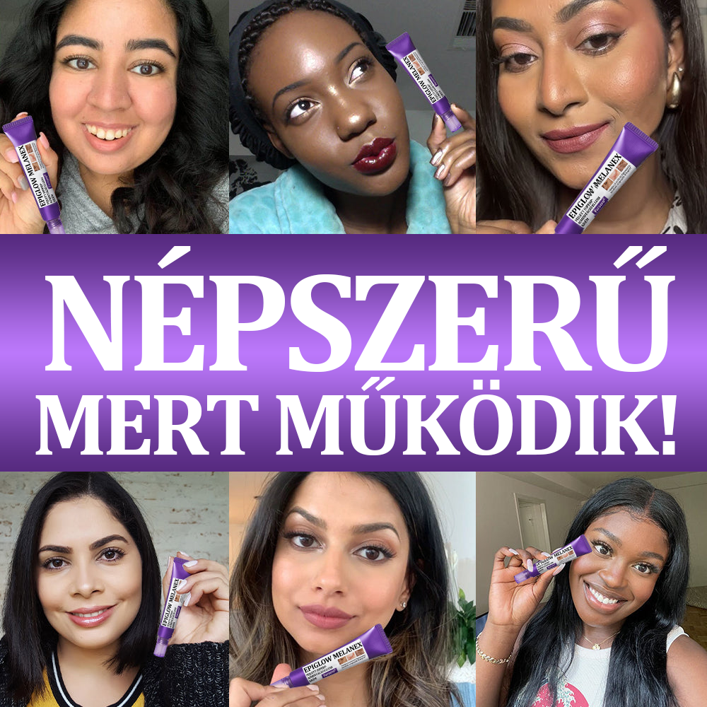 🔥🔥𝐎𝐆𝐘É𝐈 által jóváhagyva | 𝐅𝐮𝐫𝐳𝐞𝐫𝐨® 𝐄𝐏𝐈𝐆𝐋𝐎𝐖 𝐌𝐞𝐥𝐚𝐧𝐄𝐗 Fejlett Hiperpigmentáció Elleni Krém