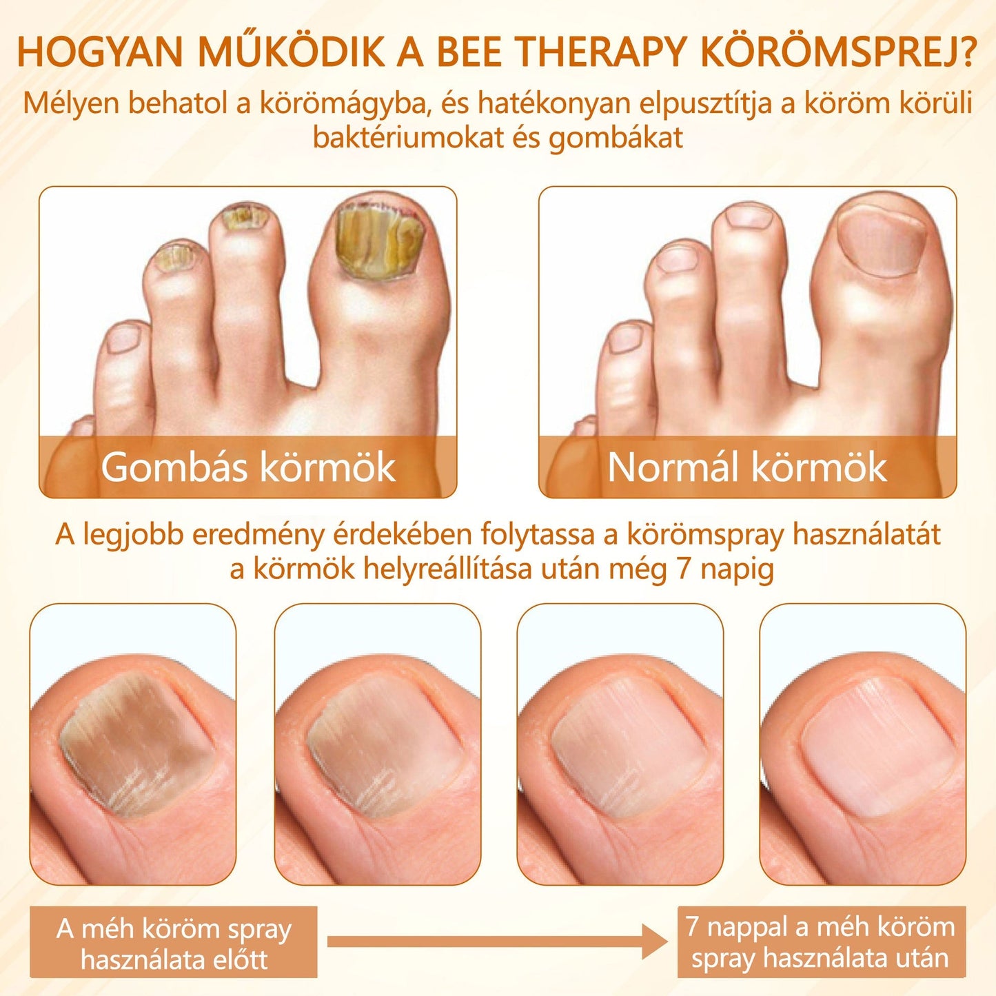 Croaie® Fungiclear Bee Therapy Nail Spray🎁