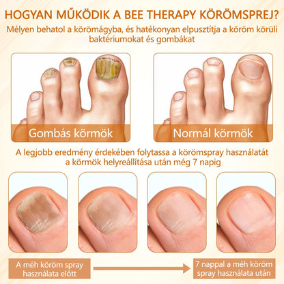 Croaie® Fungiclear Bee Therapy Nail Spray🎁