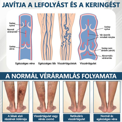 ✅✅ODEIUN® Fekete kömény Ödéma méregtelenítő gyógynövénykrém