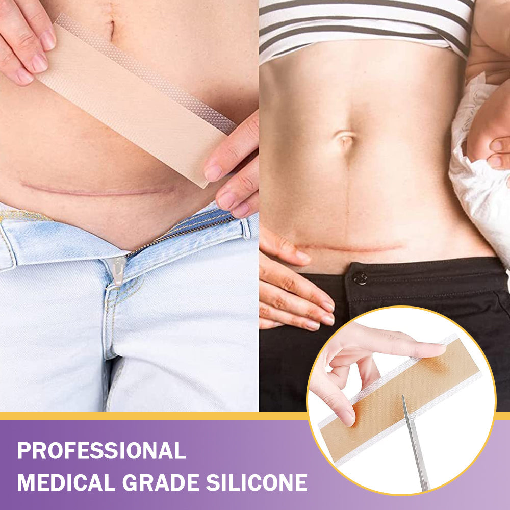 A bőr bizalmának kezdete itt van ✅ Bosstore® Hialuronsav Nano Mikrotűs Javító Tapasz ✴️ Különféle hegekre, striákra, foltokra, keloidokra, keratózisra, aknéra, égési sérülésekre, szemölcsökre, bőrcímkékre és visszértágulatokra.