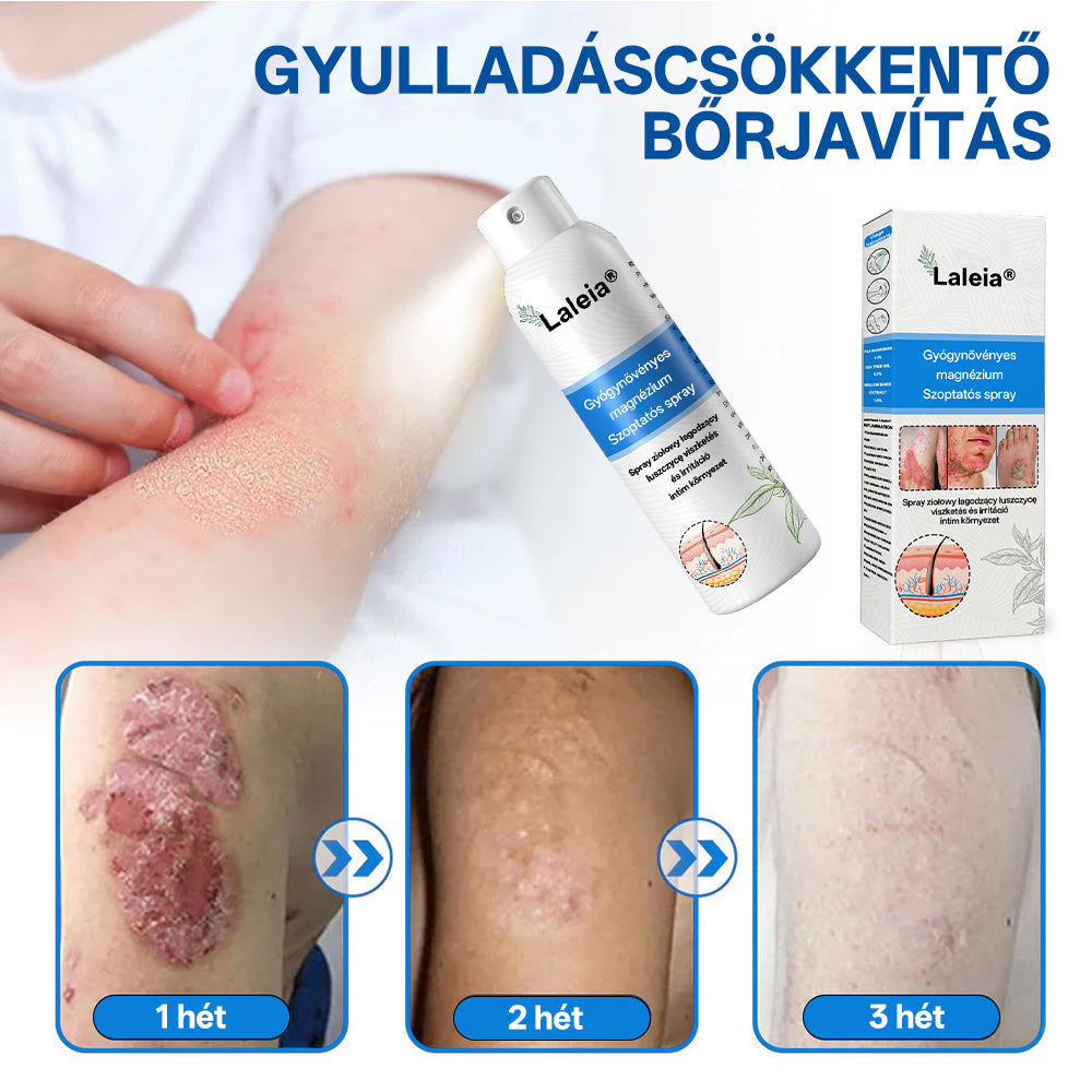 ⭐Laleia® 🎉Magnézium Gyógynövényes Pszoriázis Spray