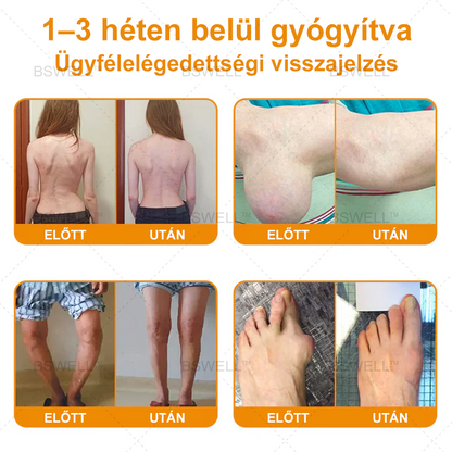 Lidocain Fájdalomcsillapító Roll-On Gélt(csökkenti az ízületi duzzanatot, fájdalmat, merevséget, bőrpírt, melegséget, fájdalmat és ízületi fáradtságot ), 4% Lidocain, Glükozamin, MSM, Arnica, Chondroitin, K2-vitamin🔥