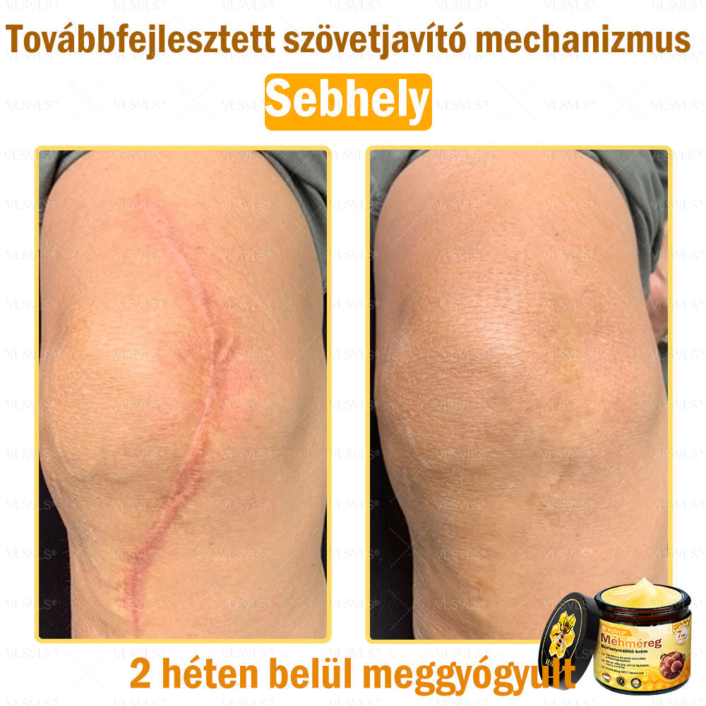 💪VLSVLS® Méhméreg Bőrhelyreállító Krém (👨‍⚕‍CE jóváhagyott)👍✅✅