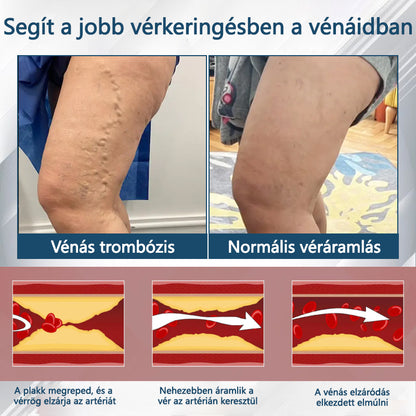 💧💧💧ATTDX® Növényi ödéma enyhítő krém nigellával