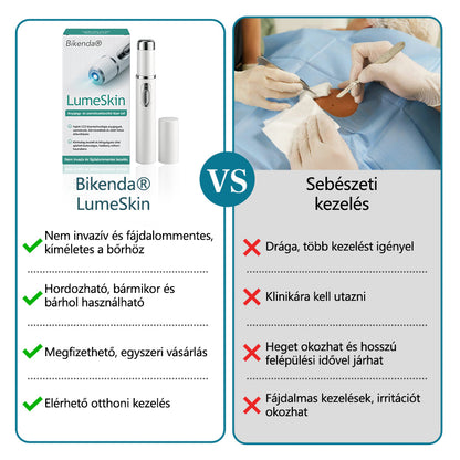 ✅Bikenda® LumeSkin anyajegy és szemölcs eltávolító lézeres toll