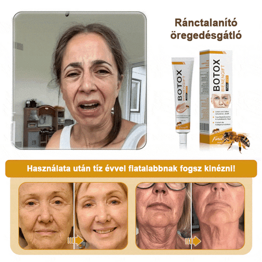 🍀Az akció utolsó napja: 83% kedvezmény✨𝐅𝐮𝐫𝐳𝐞𝐫𝐨™ Ránctalanító Krém Méhméreggel és Botox Hatással🐝