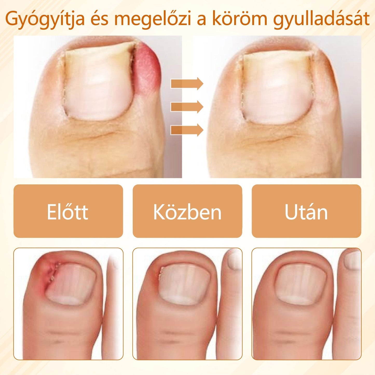 Croaie® Fungiclear Bee Therapy Nail Spray🎁