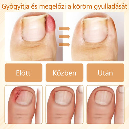 Croaie® Fungiclear Bee Therapy Nail Spray🎁