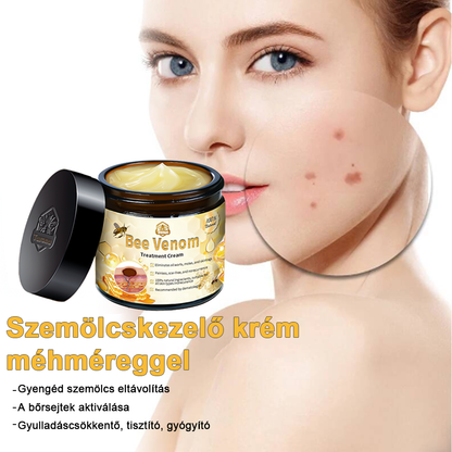 🏵️[Hivatalos zászlóshajó üzlet] 𝑻𝒖𝒓𝒐𝒏𝒖™ méhméreg bőrápoló krém (👨‍⚕𝐀𝐀𝐃 JAVASLATOK)