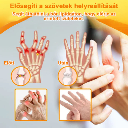 ✅Hivatalos Áruház: Ourlyard™ Magnézium Olaj és Méhméreg ízületjavító spray 👨‍⚕️ A Gyógyszerügyi Hivatal (OGYEI) jóváhagyásával.