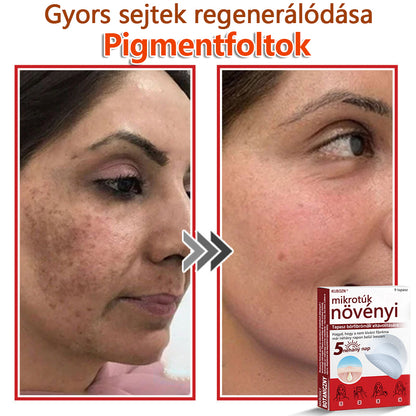 ✅KUBOZN® Mikrotűs Botanikus Bőrkinövés Eltávolító Tapaszok | Magyarországon készült