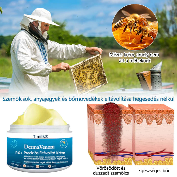 🔥🔥Timilk® DermaVenom RX+ precíziós eltávolító krém