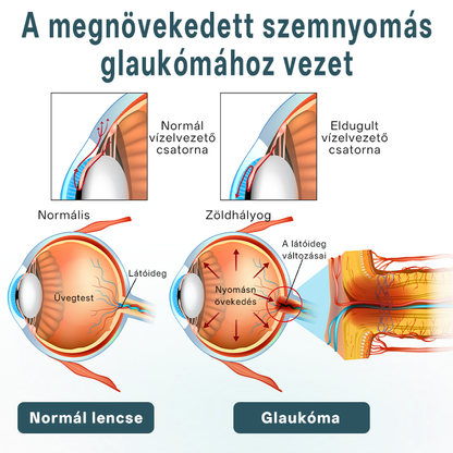 ✅Timilk® OptiFusion Nano szemcsepp szérum🎉