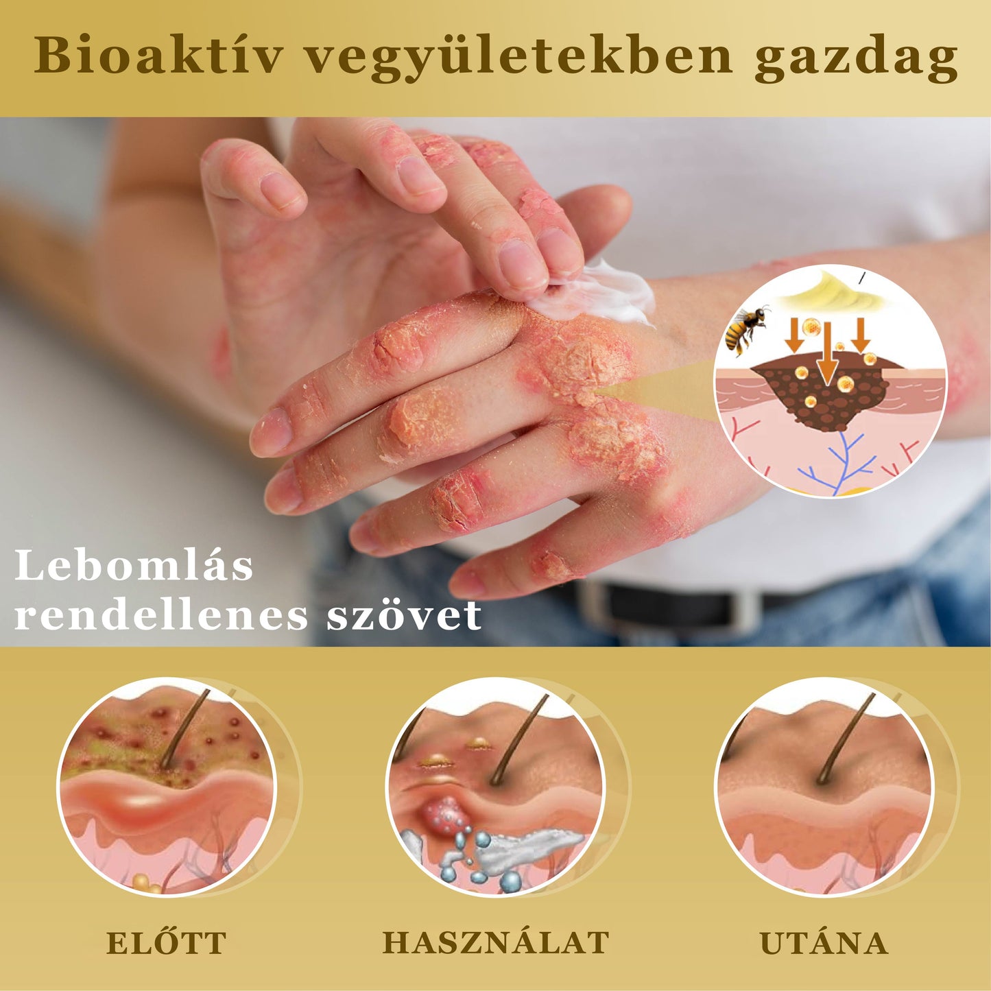 Croaie® Mellifera-méreg sűrítése bőrregeneráló krém💖