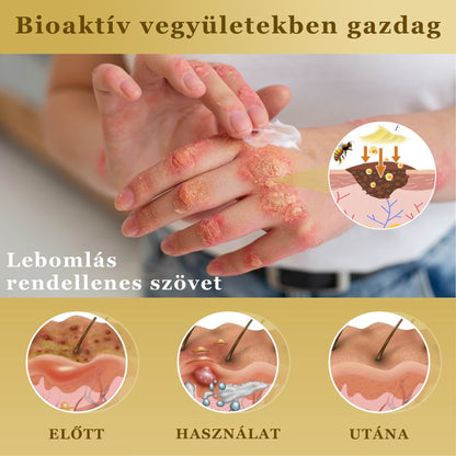 Croaie® Mellifera-méreg sűrítése bőrregeneráló krém💖