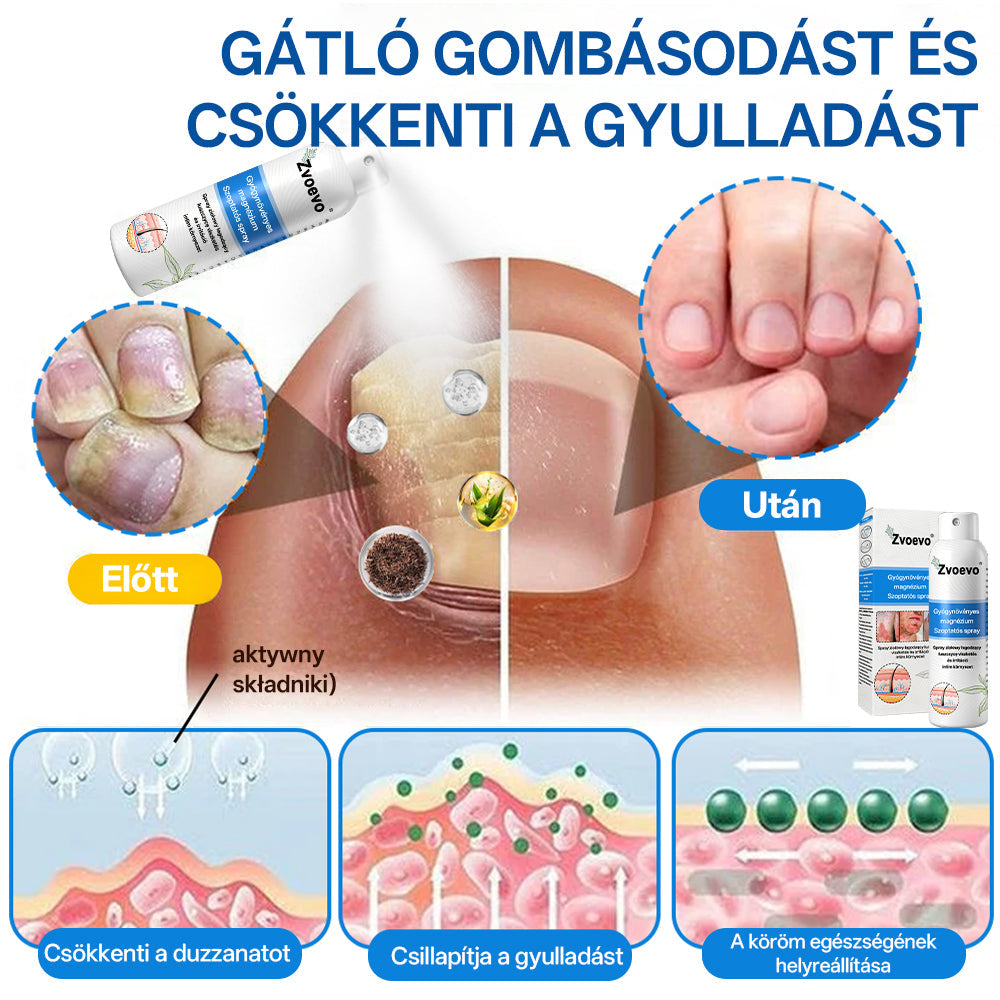 🔥🔥🔥Zvoevo® 🎉Magnézium Gyógynövényes Pszoriázis Spray